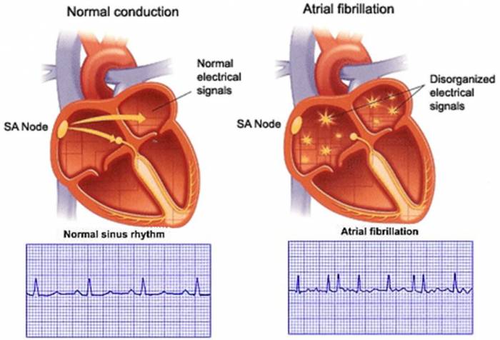 Multimodality Imaging for Best Dealing with Patients in Atrial Arrhythmias