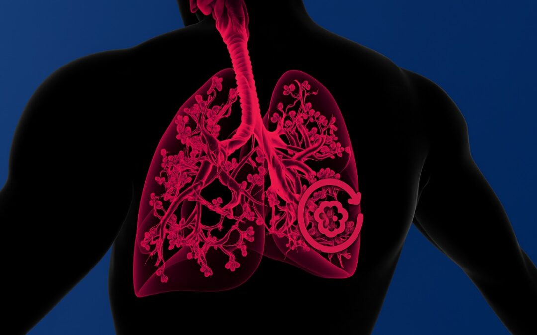 FDA Approves BRINSUPRI as First NCFB Treatment