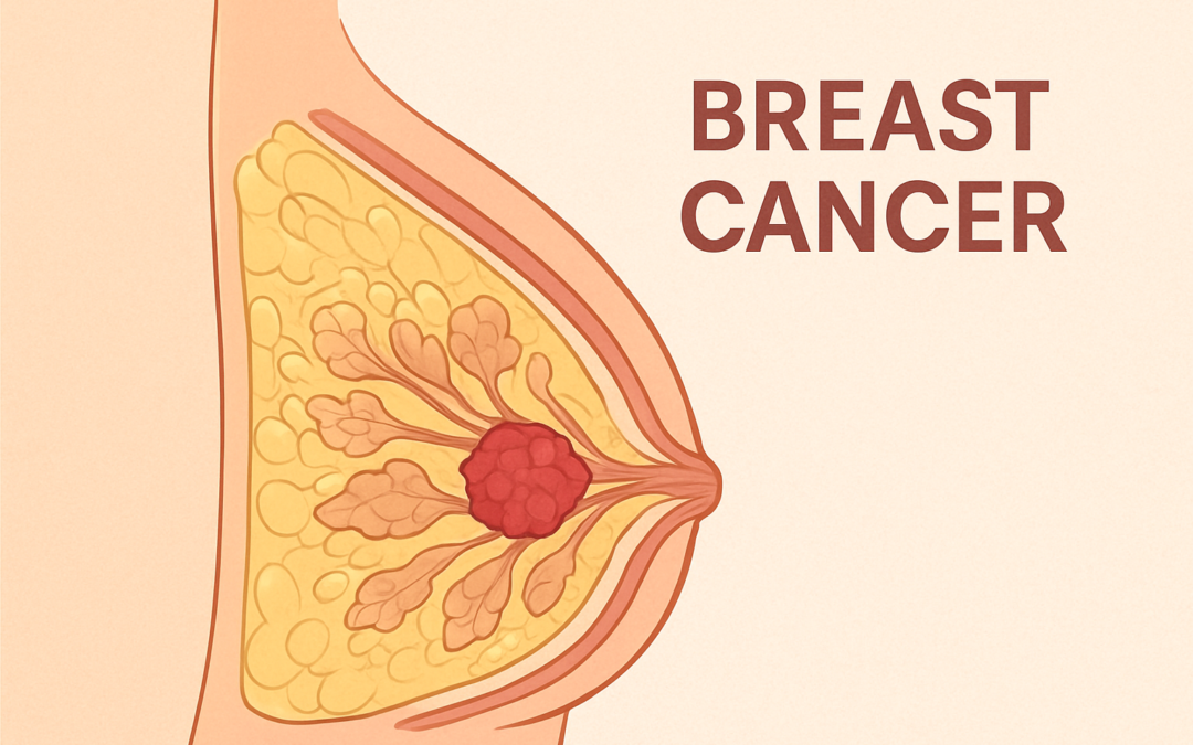 FDA Greenlights Lilly’s Inluriyo for ESR1-Mutated Advanced Breast Cancer Treatment